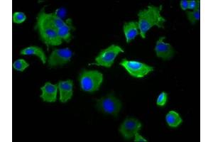 Immunofluorescence staining of MCF-7 cells with ABIN7169703 at 1:133, counter-stained with DAPI. (SIRPB1 antibody  (Isoform 3))