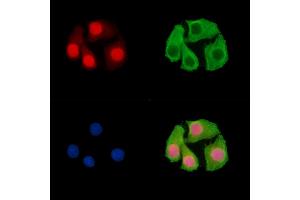 ABIN7096468 and ABIN7100532 staining Hela cells by IF/ICC. (Znf423 antibody)