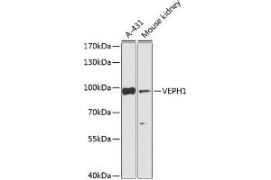 Western blot analysis of extracts of various cell lines, using VEPH1 Antibody (ABIN7271308) at 1:1000 dilution. (VEPH1 antibody  (AA 448-547))