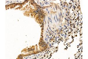 anti-Tenomodulin (TNMD) (C-Term) antibody