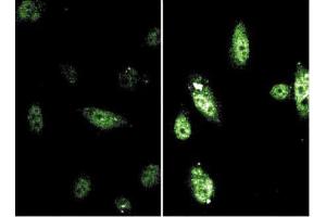 Immunofluorescence (IF) image for anti-Signal Transducer and Activator of Transcription 6, Interleukin-4 Induced (STAT6) (pTyr641) antibody (ABIN968594) (STAT6 antibody  (pTyr641))