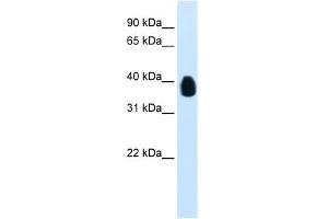 WB Suggested Anti-ETV7 Antibody Titration:  0. (ETV7 antibody  (C-Term))