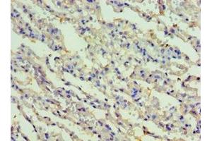 Immunohistochemistry of paraffin-embedded human lung tissue using ABIN7167479 at dilution of 1:100 (RIPK3 antibody  (AA 1-120))