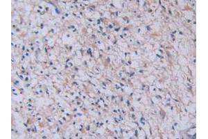 Figure. (TPSAB1 antibody  (AA 161-262))