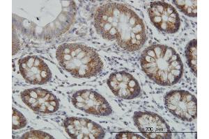 Immunoperoxidase of monoclonal antibody to MT on formalin-fixed paraffin-embedded human colon. (MCAT antibody  (AA 291-390))