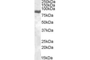 Image no. 1 for anti-Lactotransferrin (LTF) (Internal Region) antibody (ABIN375038) (Lactoferrin antibody  (Internal Region))