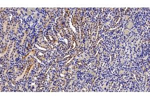 Detection of ASS1 in Rat Kidney Tissue using Polyclonal Antibody to Argininosuccinate Synthetase 1 (ASS1) (ASS1 antibody  (AA 1-412))