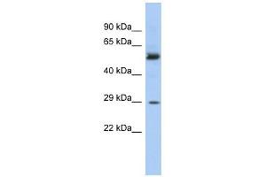 GSTM3 antibody used at 1 ug/ml to detect target protein.