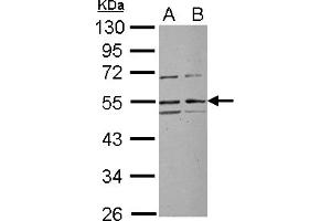 Western Blotting (WB) image for anti-Ribosomal RNA Processing 1 Homolog A (RRP1) (Internal Region) antibody (ABIN1496142) (RRP1 antibody  (Internal Region))