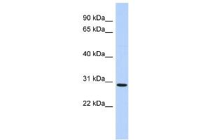 WB Suggested Anti-SERTAD2 Antibody Titration:  0. (SERTAD2 antibody  (N-Term))