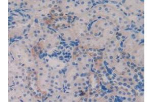 Detection of TFF3 in Rat Kidney Tissue using Polyclonal Antibody to Trefoil Factor 3 (TFF3) (TFF3 antibody  (AA 23-81))