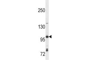 Western Blotting (WB) image for anti-Toll-Like Receptor 7 (TLR7) antibody (ABIN2998417) (TLR7 antibody)