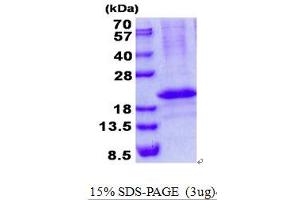 Image no. 1 for RCAN Family Member 3 (RCAN3) protein (His tag) (ABIN1098701) (RCAN3 Protein (His tag))