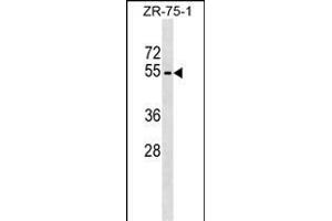 PLD4 Antibody (N-term) (ABIN1539414 and ABIN2849223) western blot analysis in ZR-75-1 cell line lysates (35 μg/lane).