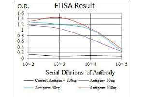 Black line: Control Antigen (100 ng), Purple line: Antigen(10 ng), Blue line: Antigen (50 ng), Red line: Antigen (100 ng), (MAP2 antibody  (AA 24-123))