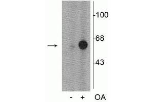 Western blot of PC-12 cell lysate incubated in the absence (-) and presence (+) of okadaic acid (OA, 1 µM for 60 min)  showing specific immunolabeling of the ~60 kDa tyrosine hydroxylase phosphorylated at Ser31. (Tyrosine Hydroxylase antibody  (pSer31))