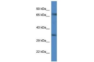 Western Blot showing Slc6a9 antibody used at a concentration of 1. (GLYT1 antibody  (C-Term))