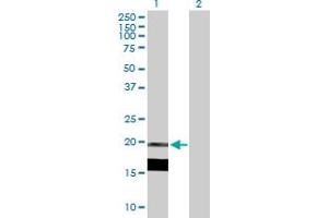 Western Blot analysis of IL7 expression in transfected 293T cell line by IL7 MaxPab polyclonal antibody. (IL-7 antibody  (AA 1-177))