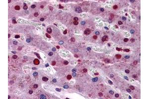 Immunohistochemical analysis of paraffin-embedded human Liver tissues using STAT3 mouse mAb (STAT3 antibody)