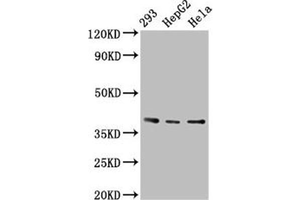 PTGR2 抗体  (AA 206-282)
