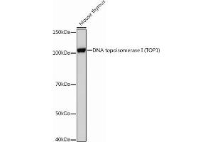 Western blot analysis of extracts of Mouse thymus, using DNA topoisomerase I (DNA topoisomerase I (TOP1)) Rabbit mAb (ABIN7270850) at 1:1000 dilution. (Topoisomerase I antibody)