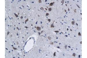 Formalin-fixed and paraffin embedded rat brain labeled with Anti-Phospho-Lyn (Tyr396) Polyclonal Antibody, Unconjugated (ABIN743618) followed by conjugation to the secondary antibody and DAB staining (LYN antibody  (pTyr397))