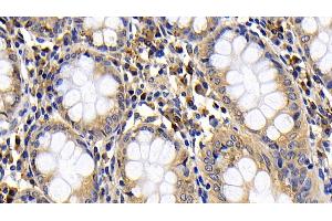 Immunohistochemistry (IHC) image for anti-BCL2-Like 11 (Apoptosis Facilitator) (BCL2L11) (AA 2-120) antibody (ABIN7430234)