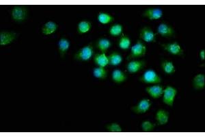 Immunofluorescence staining of A549 cells with ABIN7145207 at 1:266, counter-stained with DAPI. (Survivin antibody  (AA 1-130))
