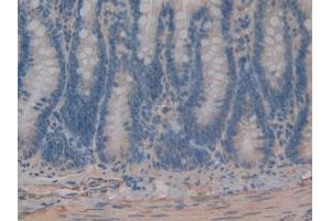 DAB staining on IHC-P; Samples: Rat Intestine Tissue (C8B antibody  (AA 161-503))