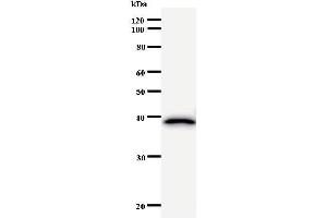 Western Blotting (WB) image for anti-Ras Homolog Gene Family, Member B (RHOB) antibody (ABIN931074) (RHOB antibody)