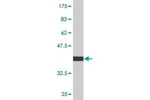 Western Blot detection against Immunogen (36. (CDKN1B antibody  (AA 100-198))