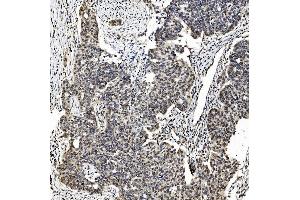 IHC analysis of TAF4 using anti-TAF4 antibody (ABIN7602114).