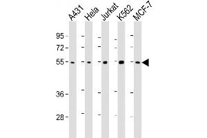 Lane 1: A431, Lane 2: HeLa, Lane 3: Jurkat, Lane 4: K562, Lane 5: MCF-7 cell lysates at 20ug per lane, probed with bsm-51266M CHK1 (2G1D5) Monoclonal Antibody at 1:1000 overnight at 4°C followed by a conjugated secondary antibody for 60 minutes at 37°C. (CHEK1 antibody)