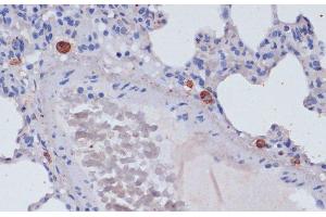 Immunohistochemistry of paraffin-embedded Rat lung using Perforin Polyclonal Antibody at dilution of 1:100 (40x lens).