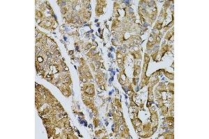 Immunohistochemistry of paraffin-embedded human stomach using MYL1 antibody. (MYL1 antibody  (AA 1-150))