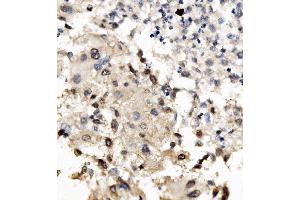 IHC analysis of MNT using anti-MNT antibody (ABIN7601555). (MNT antibody  (AA 381-564))