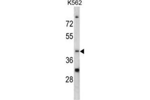 Western Blotting (WB) image for anti-CCR4 Carbon Catabolite Repression 4-Like (CCRN4L) antibody (ABIN3002711) (CCRN4L antibody)