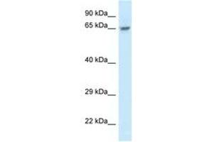 Image no. 1 for anti-Family with Sequence Similarity 161, Member A (FAM161A) (AA 229-278) antibody (ABIN6747443) (FAM161A antibody  (AA 229-278))