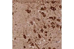 Immunohistochemical staining of human hippocampus with KARS polyclonal antibody  shows strong cytoplasmic positivity in neuronal cells at 1:500-1:1000 dilution.