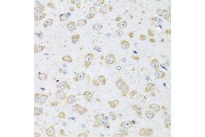 Immunohistochemistry of paraffin-embedded mouse brain using ALB antibody (ABIN5969844) at dilution of 1/100 (40x lens). (Albumin antibody)