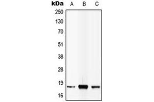 Western blot analysis of IL-4 expression in MCF7 (A), SP2/0 (B), PC12 (C) whole cell lysates. (IL-4 antibody  (C-Term))