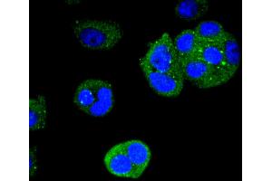 MCF-7 cells were stained with Cytokeratin 4 (2F9) Monoclonal Antibody  at [1:200] incubated overnight at 4C, followed by secondary antibody incubation, DAPI staining of the nuclei and detection. (KRT4 antibody)