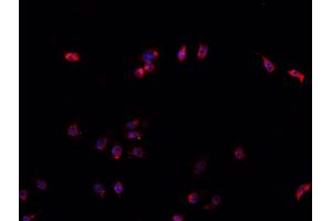 ABIN6266561 staining U-2 OS cells by IF/ICC. (HDAC9 antibody  (C-Term))