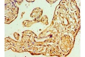 Immunohistochemistry of paraffin-embedded human placenta tissue using ABIN7144666 at dilution of 1:100 (AIPL1 antibody  (AA 1-384))