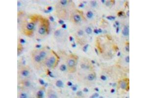 IHC-P analysis of Liver tissue, with DAB staining. (CD97 antibody  (AA 32-173))
