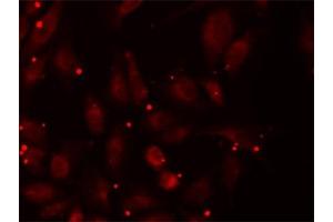 Immunofluorescence (IF) image for anti-Propionyl CoA Carboxylase beta Polypeptide (PCCB) antibody (ABIN1876603) (PCCB antibody)
