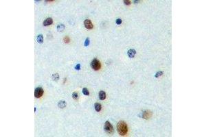 Immunohistochemical analysis of FOXN4 staining in human brain formalin fixed paraffin embedded tissue section. (FOXN4 antibody  (C-Term))