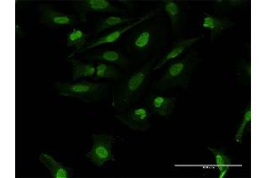 Immunofluorescence of purified MaxPab antibody to FOSL2 on HeLa cell. (FOSL2 antibody  (AA 1-326))