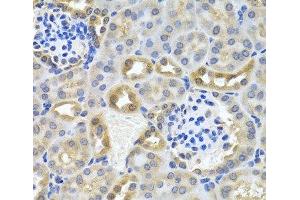 Immunohistochemistry of paraffin-embedded Mouse kidney using DEDD Polyclonal Antibody at dilution of 1:100 (40x lens). (DEDD antibody)