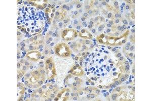 Immunohistochemistry of paraffin-embedded Mouse kidney using DEDD Polyclonal Antibody at dilution of 1:100 (40x lens).